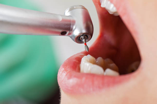 Best Pediatric Emergency Dentist in Grand Saline, TX